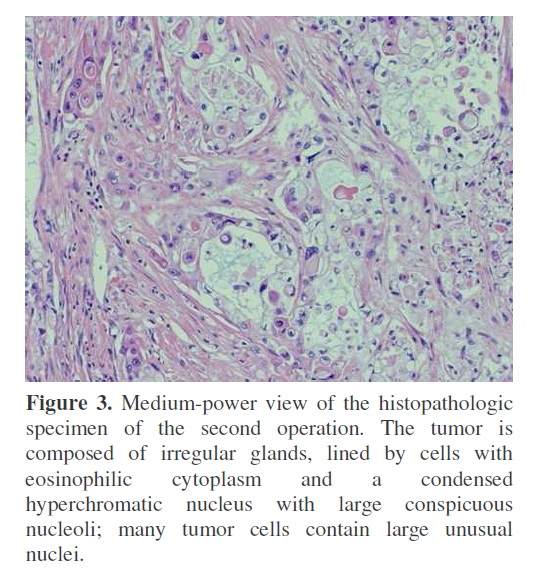 pancreas-composed-irregular-glands