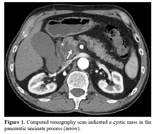 pancreas-computed-tomography