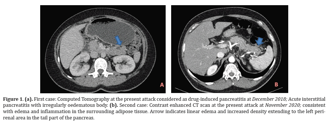 pancreas-computed-tomography