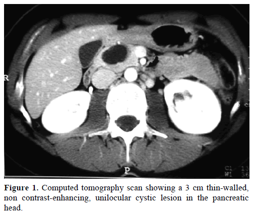 pancreas-computed-tomography-3-cm-thin