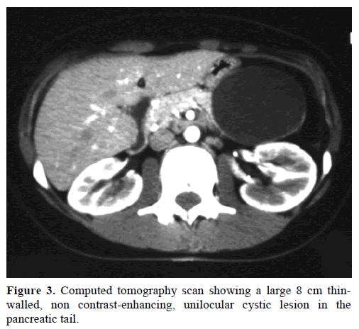 pancreas-computed-tomography-8-cm-thin