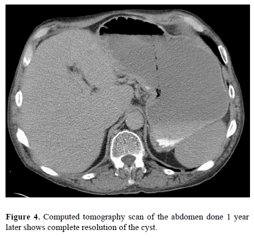 pancreas-computed-tomography-complete-resolution