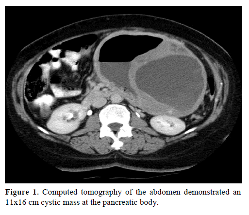 pancreas-computed-tomography-cystic