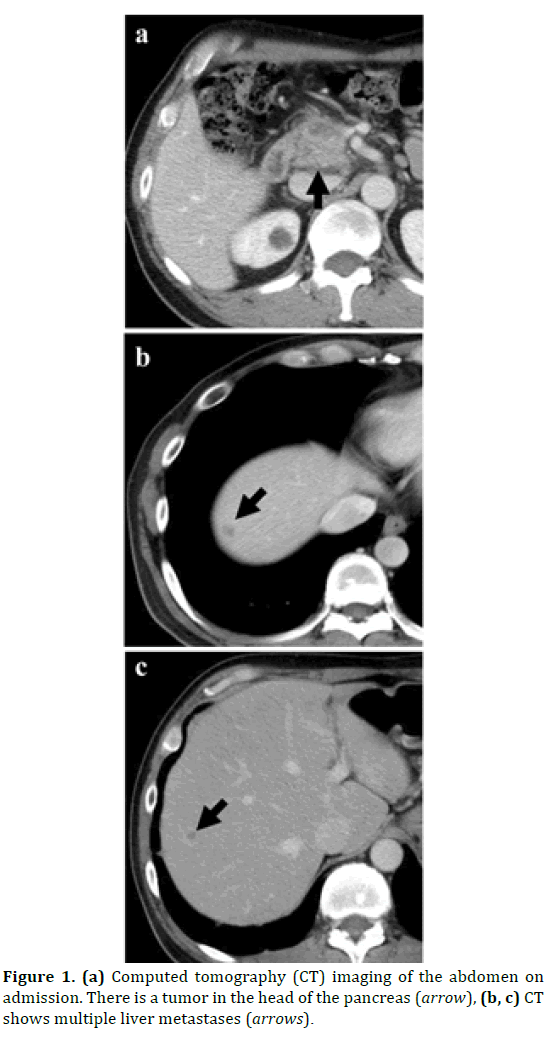 pancreas-computed-tomography-imaging