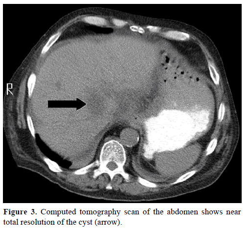 pancreas-computed-tomography-near-resolution