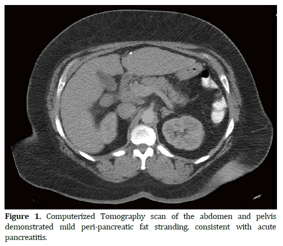pancreas-computerized-tomography-scan