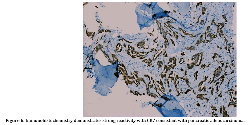 pancreas-consistent