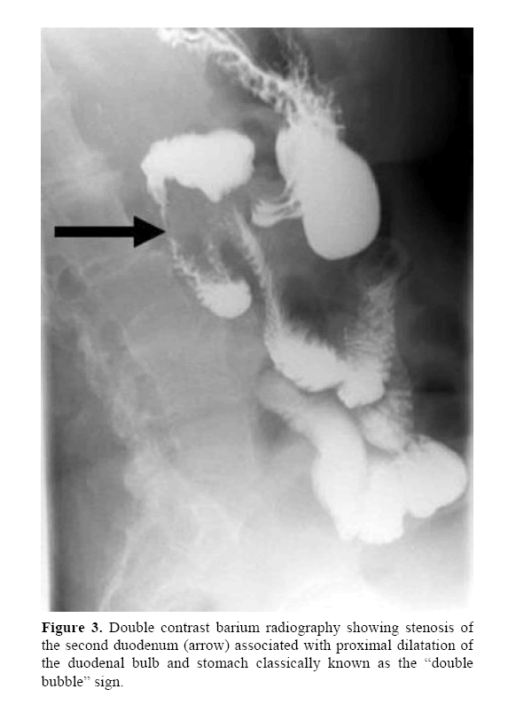 pancreas-contrast-barium-radiography