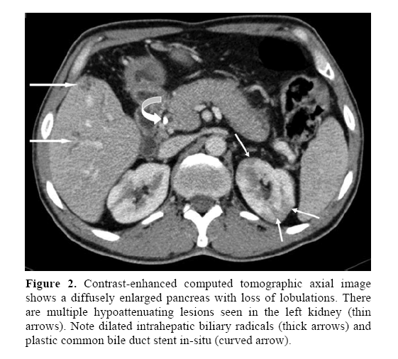 pancreas-contrast-enhanced