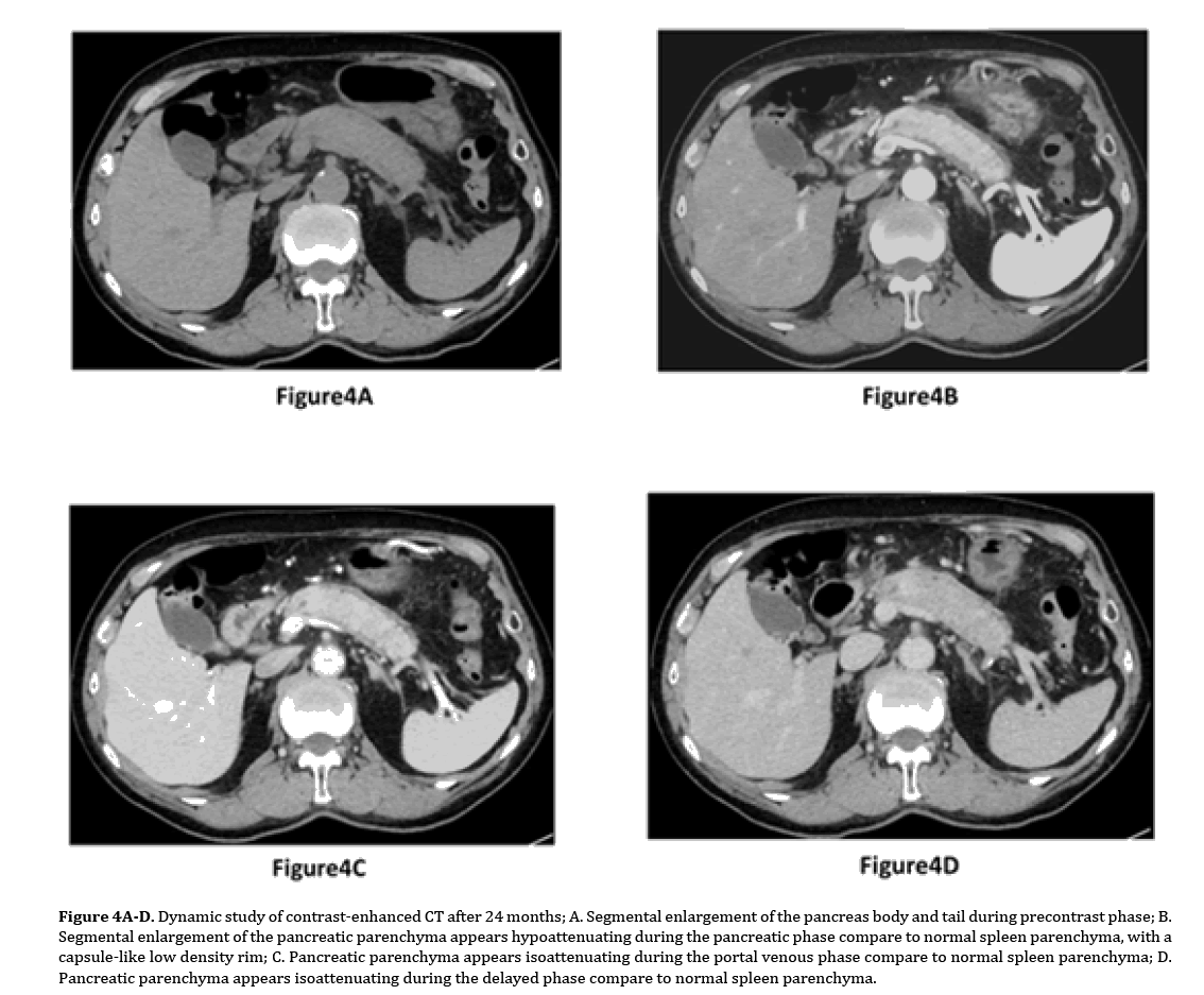 pancreas-contrast-enhanced-CT