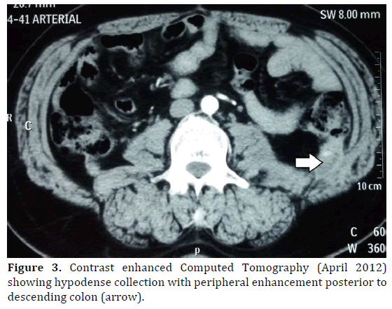 pancreas-contrast-enhanced-Computed