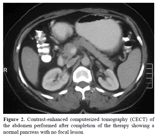 pancreas-contrast-enhanced-abdomen