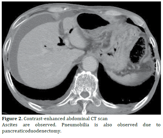 pancreas-contrast-enhanced-abdominal