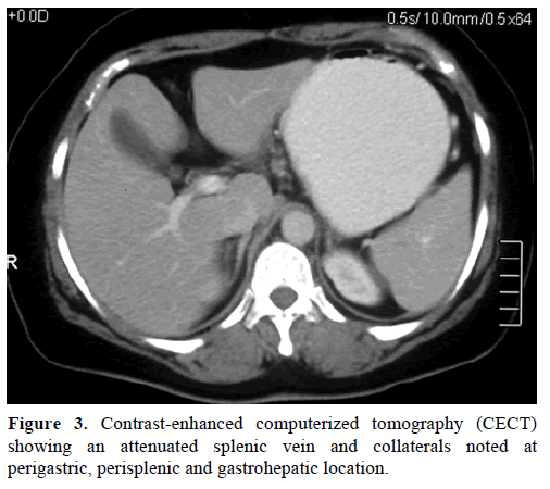 pancreas-contrast-enhanced-attenuated