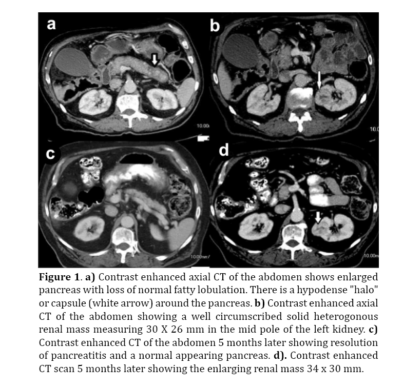 pancreas-contrast-enhanced-axial