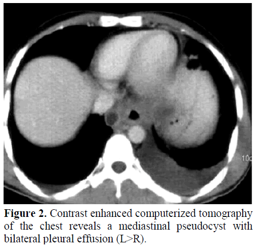 pancreas-contrast-enhanced-bilateral