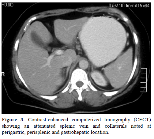 pancreas-contrast-enhanced-bulky-head