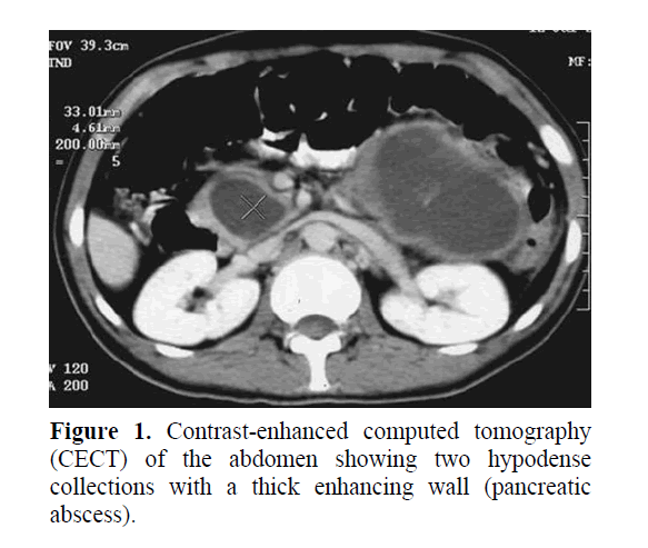 pancreas-contrast-enhanced-computed