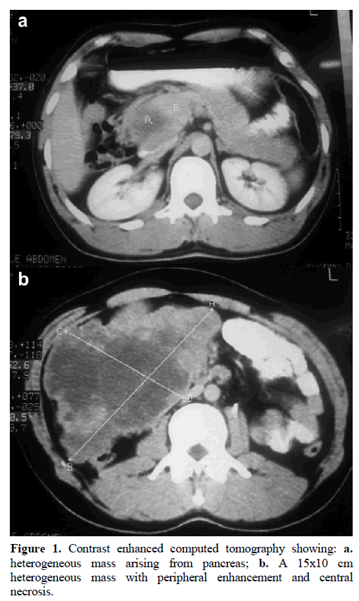 pancreas-contrast-enhanced-computed-tomography