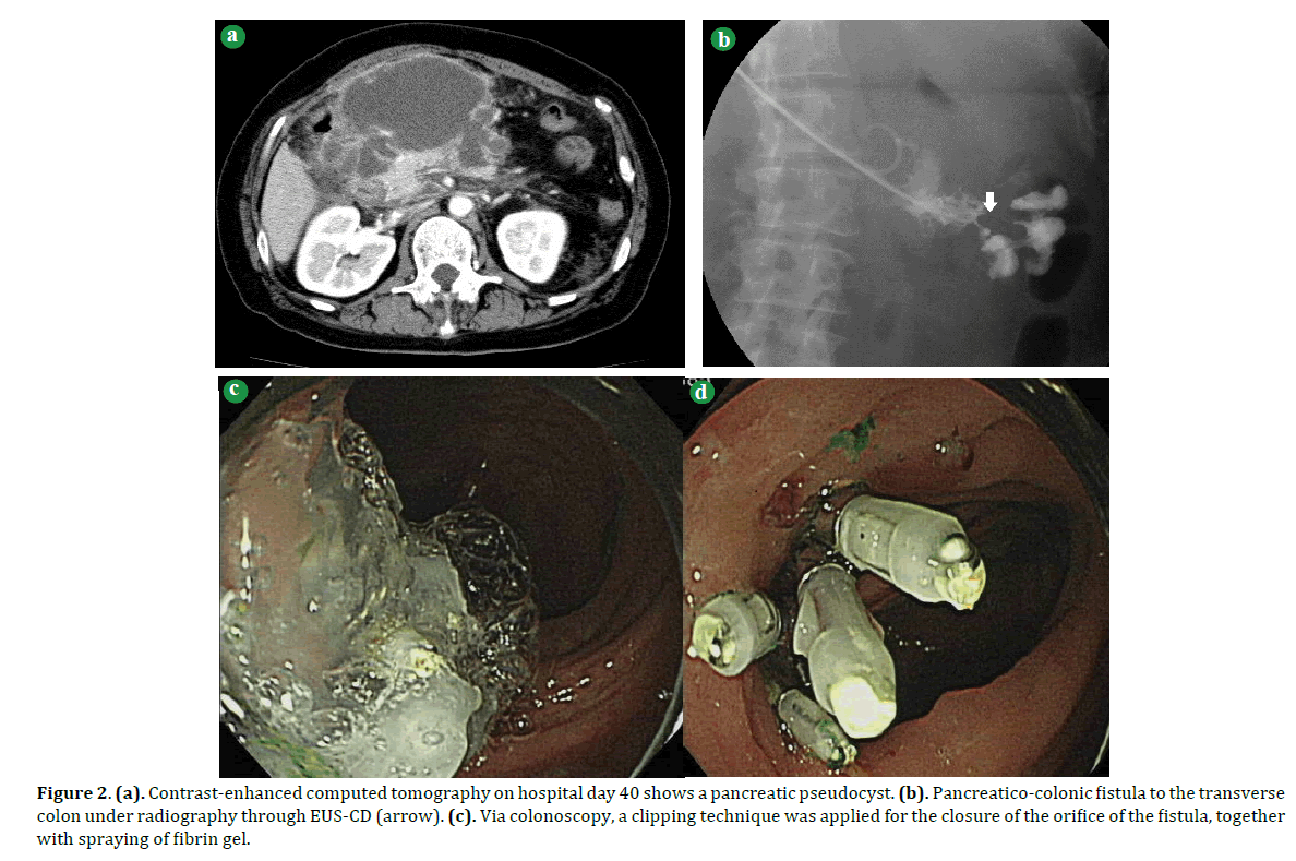 pancreas-contrast-enhanced-computed-tomography