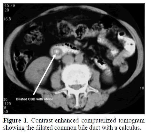 pancreas-contrast-enhanced-computerized
