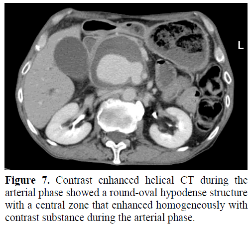 pancreas-contrast-enhanced-helical
