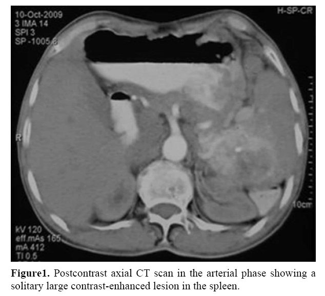 pancreas-contrast-enhanced-lesion