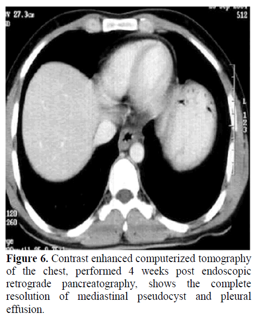 pancreas-contrast-enhanced-mediastinal