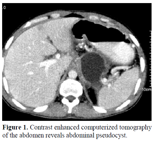 pancreas-contrast-enhanced-pseudocyst