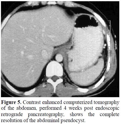 pancreas-contrast-enhanced-retrograde