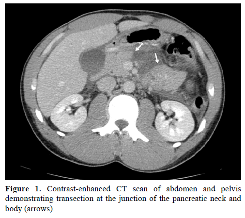 pancreas-contrast-enhanced-scan