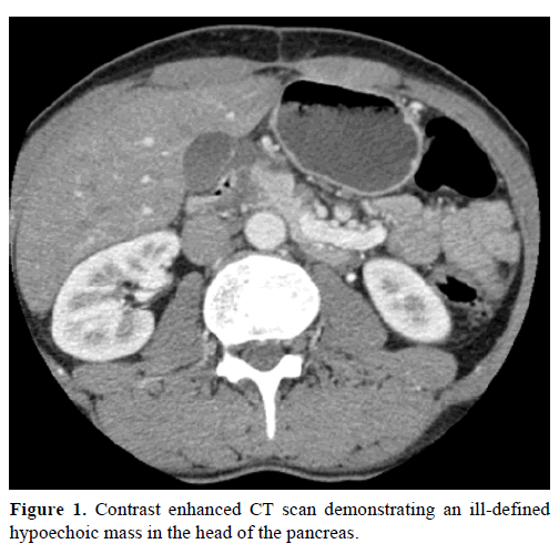 pancreas-contrast-enhanced-scan