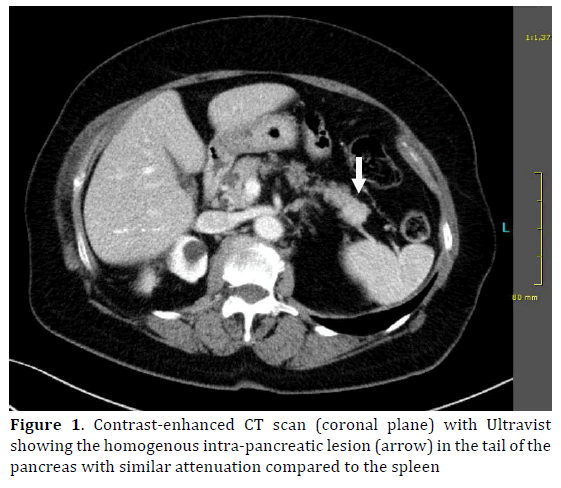pancreas-contrast-enhanced-scan