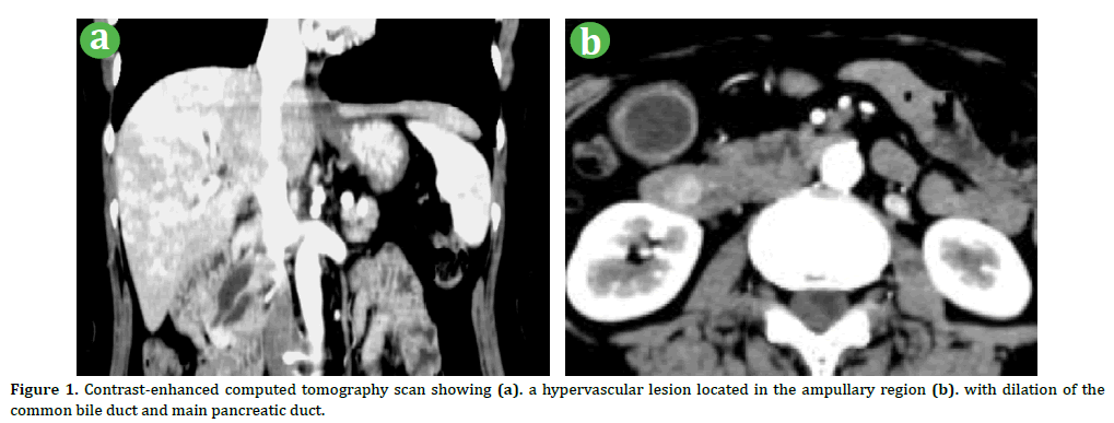 pancreas-contrast-enhanced-tomography