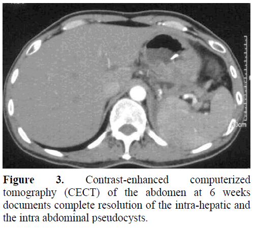 pancreas-contrast-enhanced-tomography