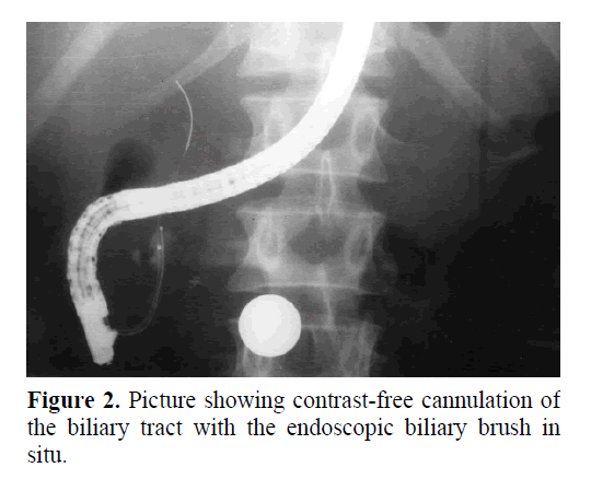 pancreas-contrast-free-cannulation