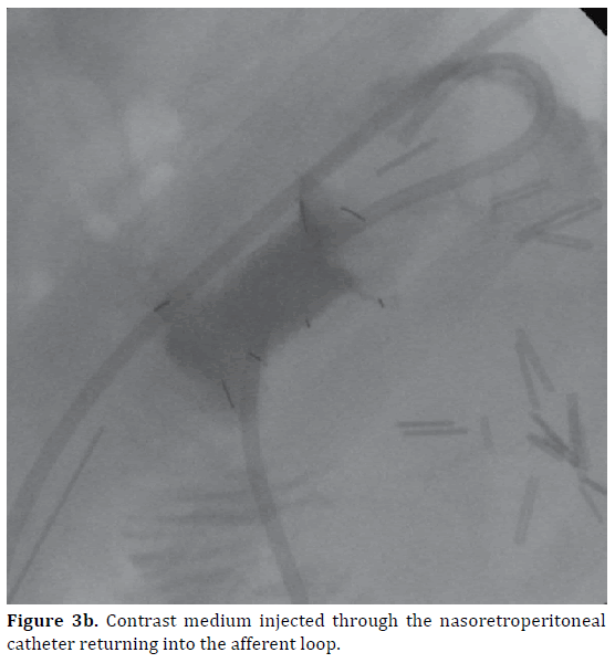 pancreas-contrast-medium