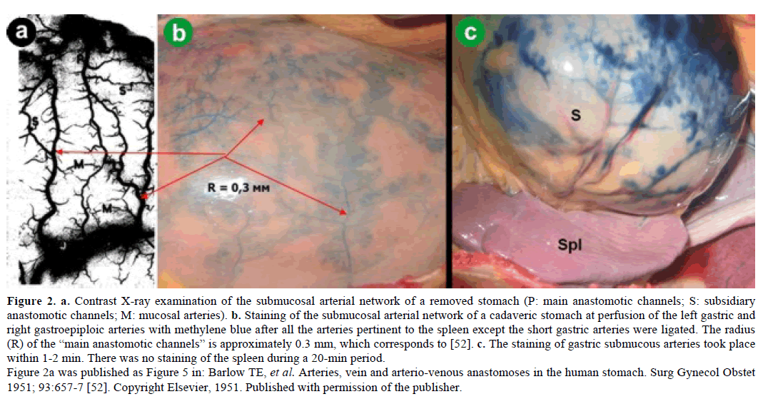 pancreas-contrast-x-ray-examination