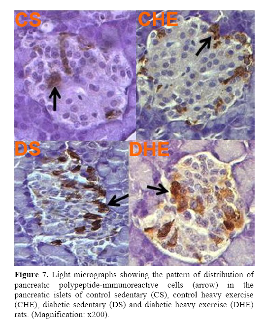 pancreas-control-sedentary