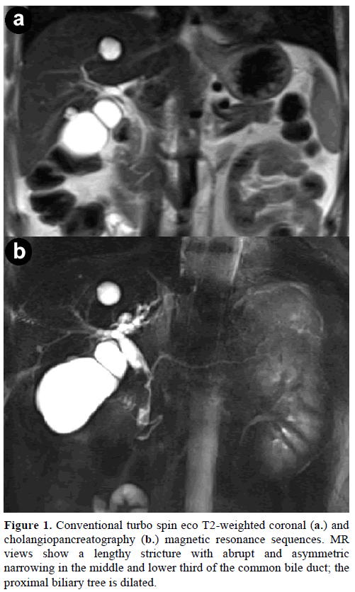 pancreas-conventional-turbo-spin