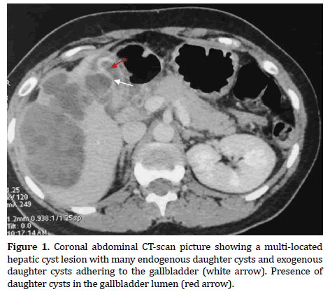 pancreas-coronal-abdominal