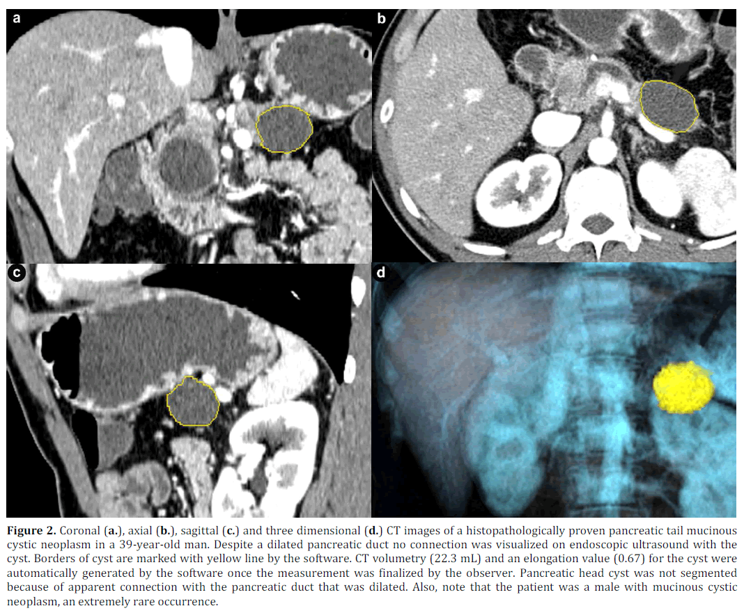 pancreas-coronal-axial-sagittal-dimensional