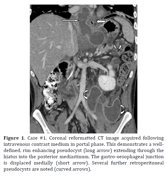 pancreas-coronal-reformatted