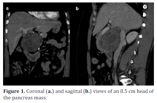 pancreas-coronal-sagittal-head