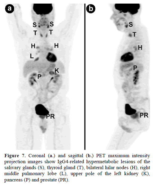 pancreas-coronal-sagittal-projection