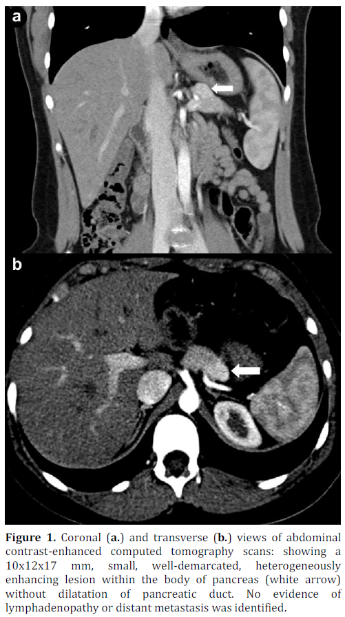 pancreas-coronal-transverse-abdominal