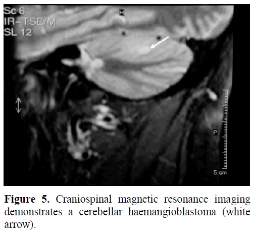 pancreas-craniospinal-magnetic-cerebellar