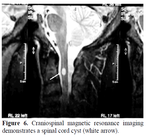 pancreas-craniospinal-magnetic-spinal-cord