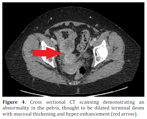 pancreas-cross-sectional-demonstrating
