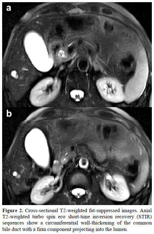 pancreas-cross-sectional-turbo-spin